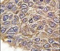 Aldolase A Antibody in Immunohistochemistry (IHC)