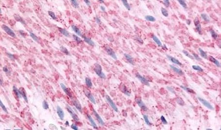 alpha-2c Adrenergic Receptor Antibody in Immunohistochemistry (Paraffin) (IHC (P))