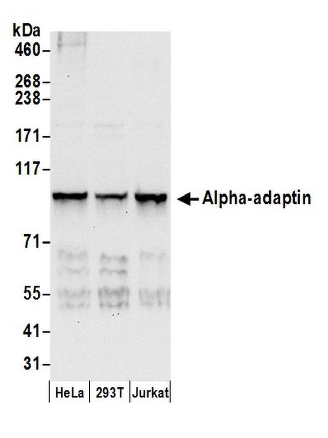 Alpha-adaptin Antibody in Western Blot (WB)