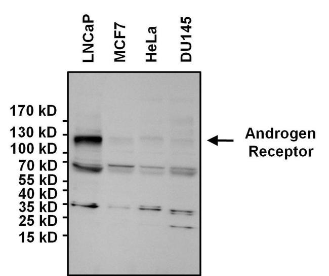 Androgen Receptor Antibody in Western Blot (WB)