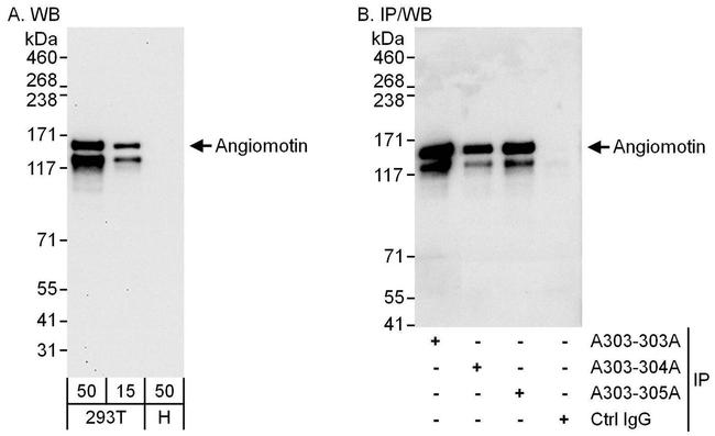 Angiomotin Antibody in Western Blot (WB)