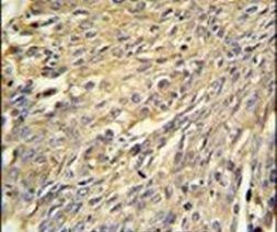Annexin A1 Antibody in Immunohistochemistry (IHC)