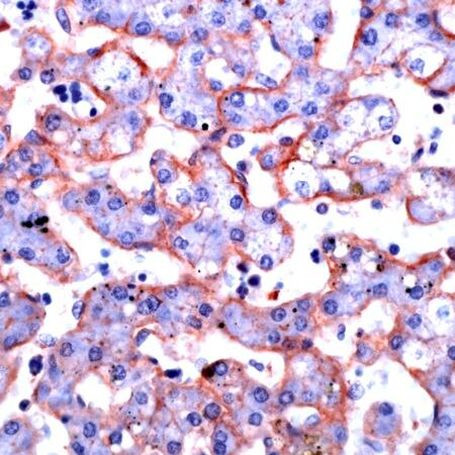 Annexin A6 Antibody in Immunohistochemistry (IHC)