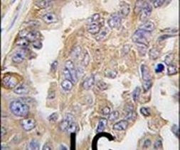 AGR2 Antibody in Immunohistochemistry (IHC)