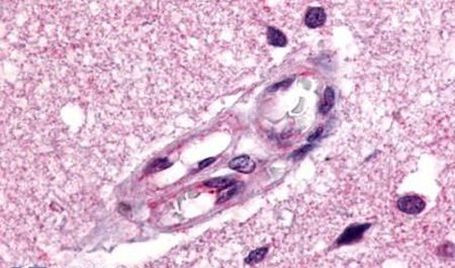 Apelin Receptor Antibody in Immunohistochemistry (Paraffin) (IHC (P))