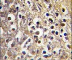 Aromatase Antibody in Immunohistochemistry (IHC)
