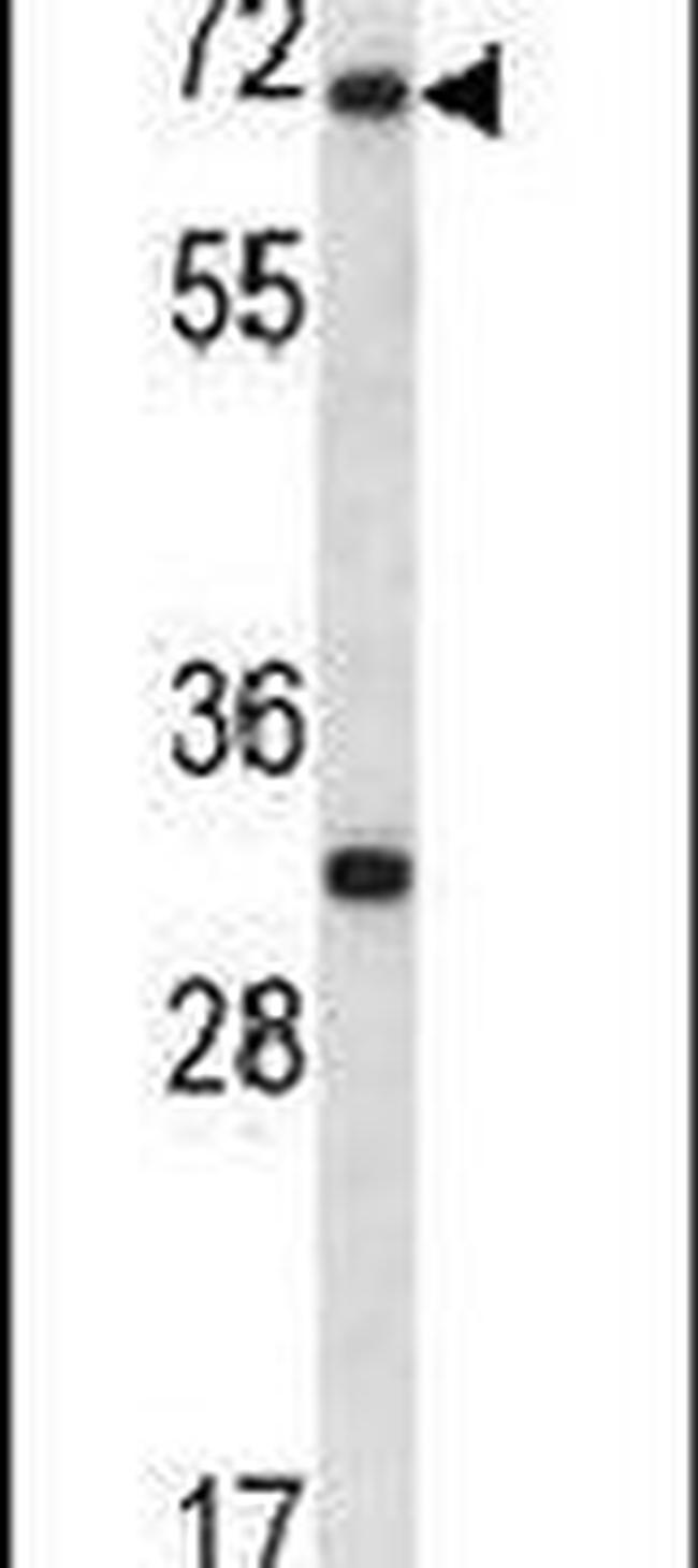 ARX Antibody in Western Blot (WB)
