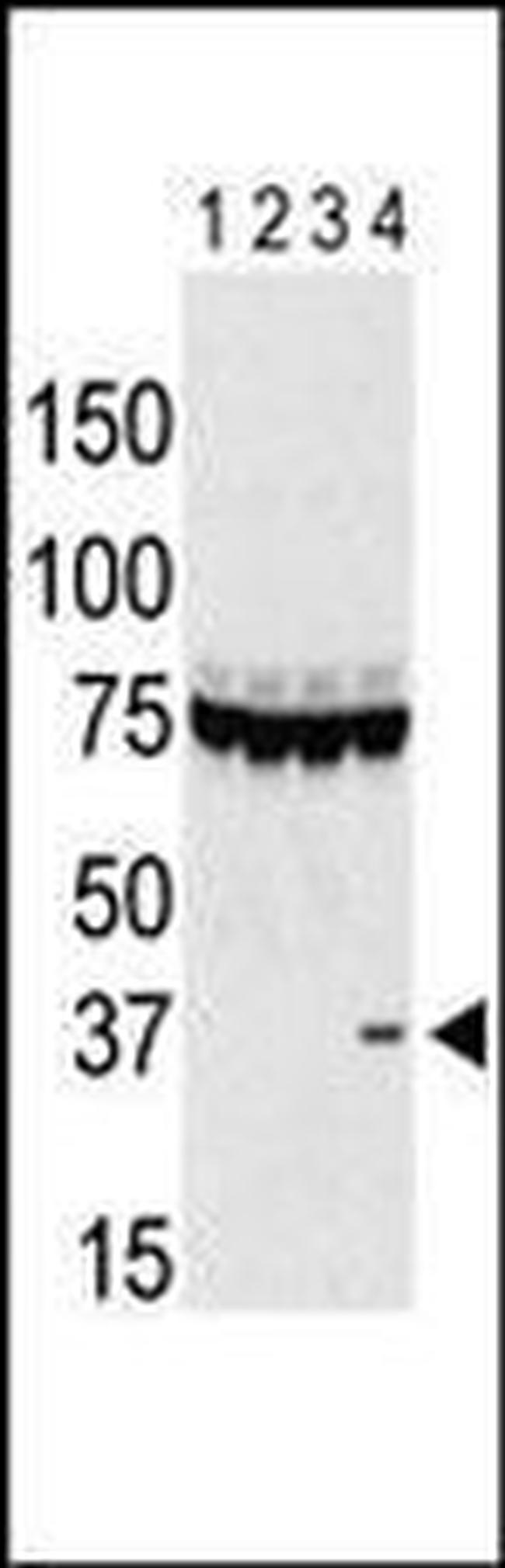 Aurora C Antibody in Western Blot (WB)