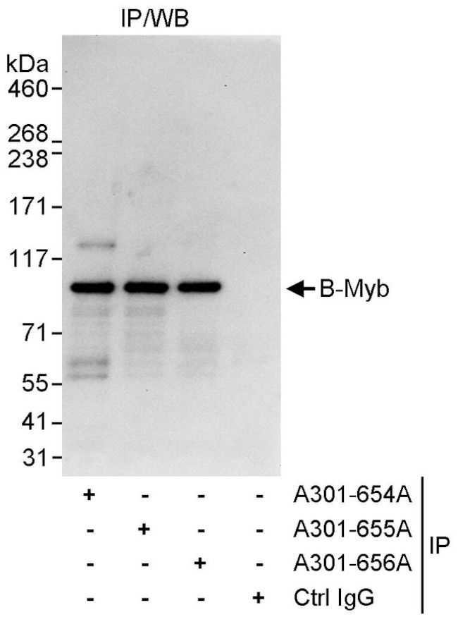 B Myb Polyclonal Antibody A301 654A b-myb-polyclonal-antibody-a301-654a
