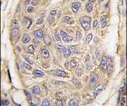 beta-2 Microglobulin Antibody in Immunohistochemistry (IHC)