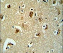 B3GALT6 Antibody in Immunohistochemistry (IHC)