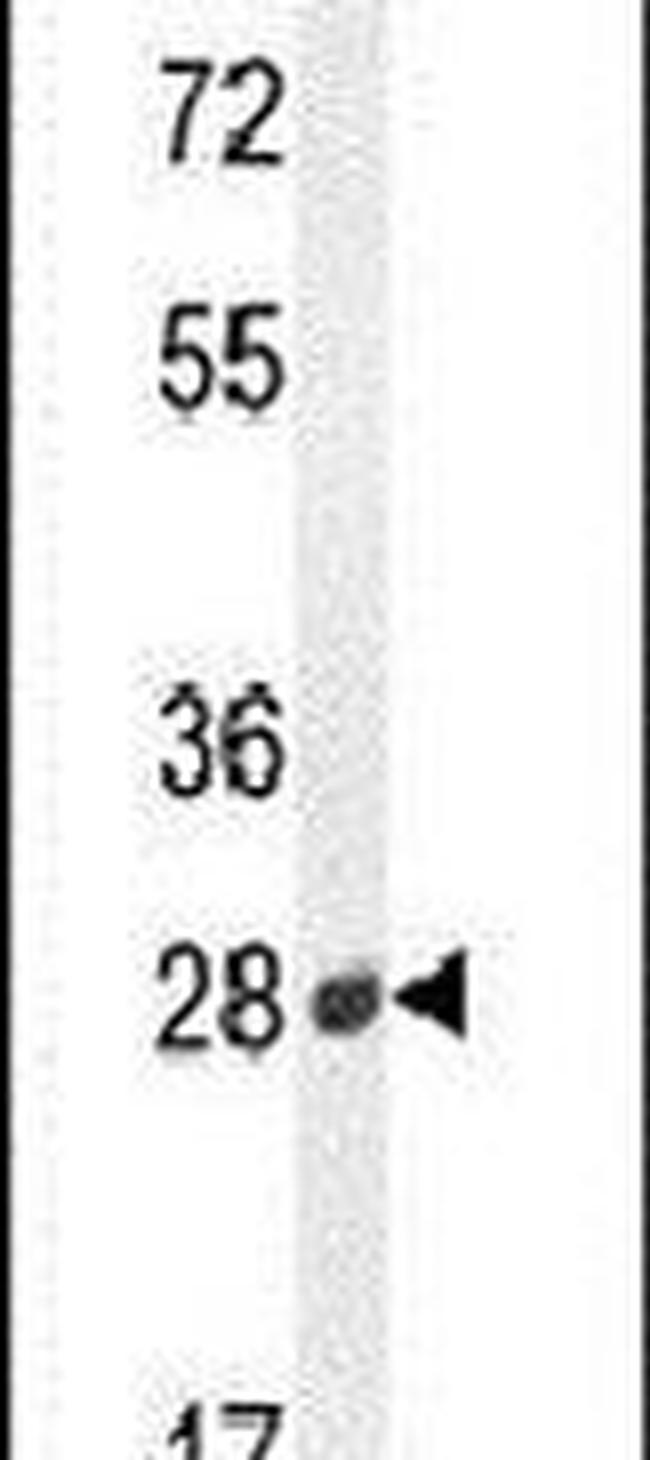 B3GAT2 Antibody in Western Blot (WB)