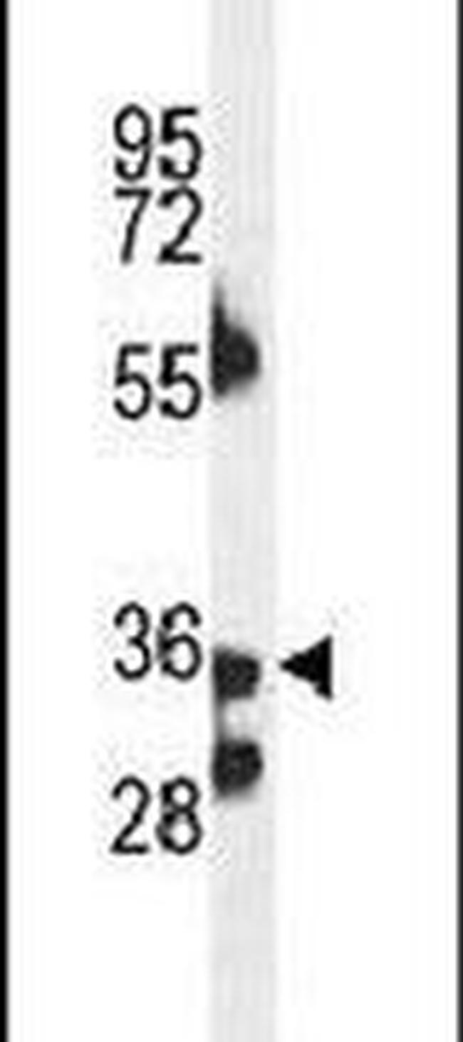 B3GNT4 Antibody in Western Blot (WB)