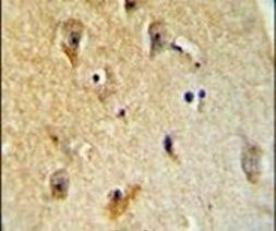 B4GALT6 Antibody in Immunohistochemistry (IHC)