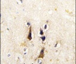 BACE1 Antibody in Immunohistochemistry (IHC)