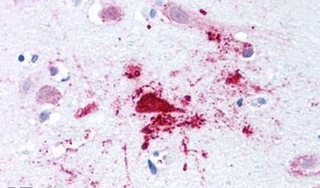 BACE1 Antibody in Immunohistochemistry (Paraffin) (IHC (P))