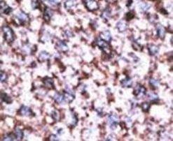 BACE2 Antibody in Immunohistochemistry (IHC)