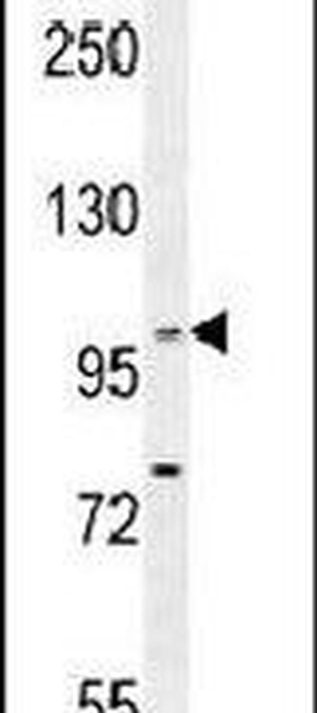 BACH2 Antibody in Western Blot (WB)