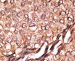 BAIAP2 Antibody in Immunohistochemistry (IHC)