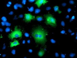 BAIAP2 Antibody in Immunocytochemistry (ICC/IF)