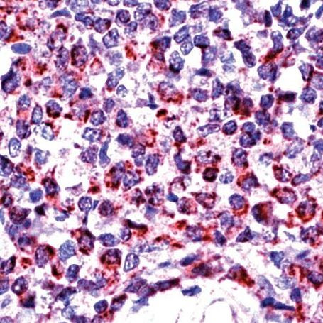 BAK Antibody in Immunohistochemistry (IHC)