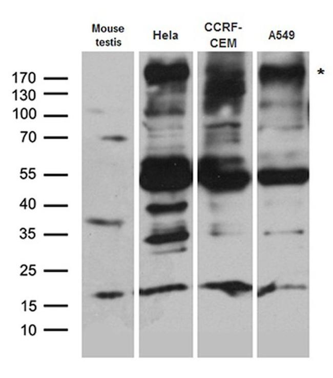 BAZ1A Antibody in Western Blot (WB)