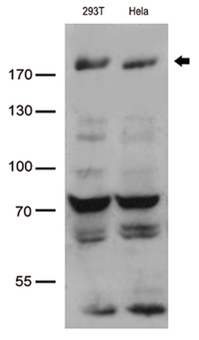 BAZ1B Antibody in Western Blot (WB)