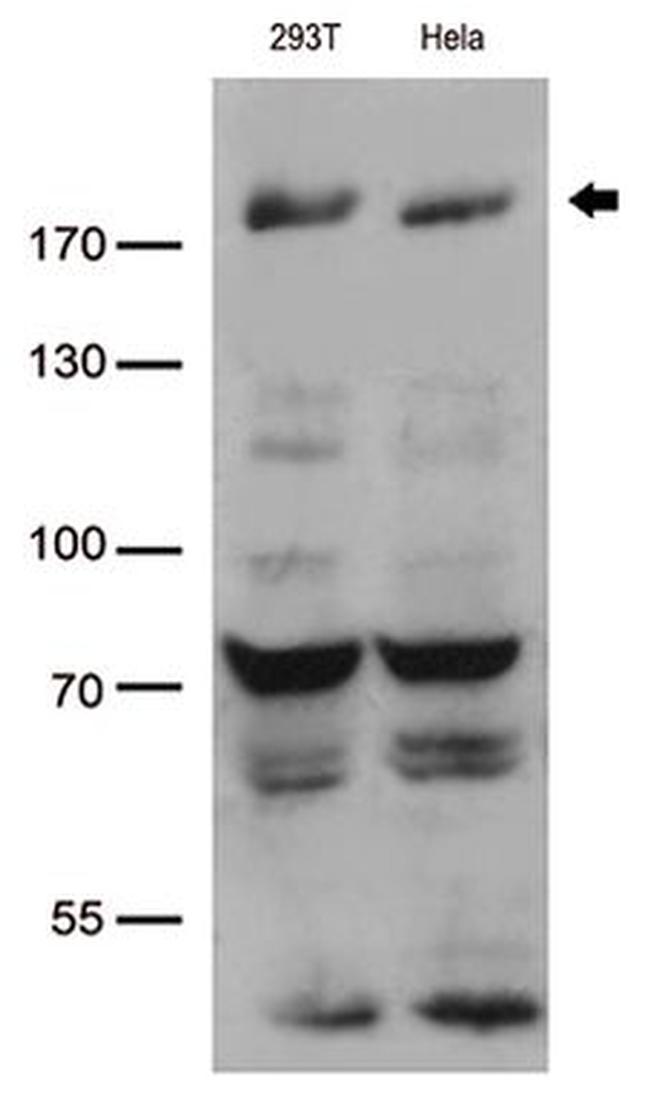 BAZ1B Antibody in Western Blot (WB)