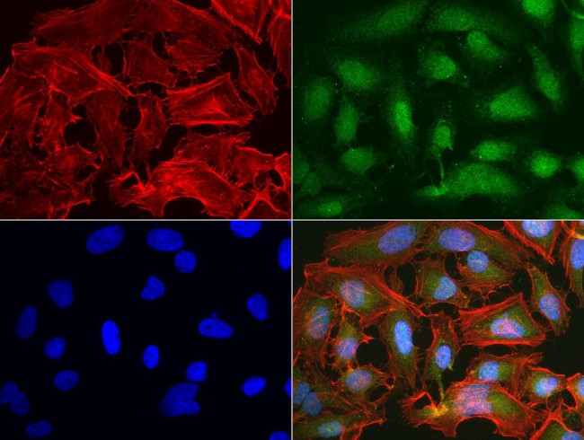 BBOX1 Antibody in Immunocytochemistry (ICC/IF)