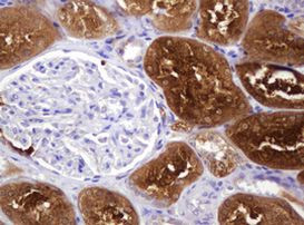 BBOX1 Antibody in Immunohistochemistry (Paraffin) (IHC (P))