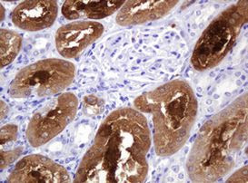 BBOX1 Antibody in Immunohistochemistry (Paraffin) (IHC (P))
