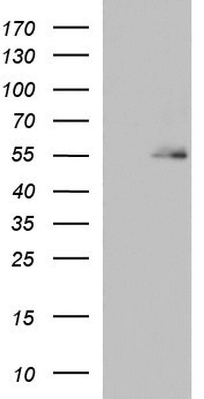 BBS4 Antibody in Western Blot (WB)