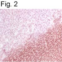 BAP31 Antibody in Immunohistochemistry (IHC)