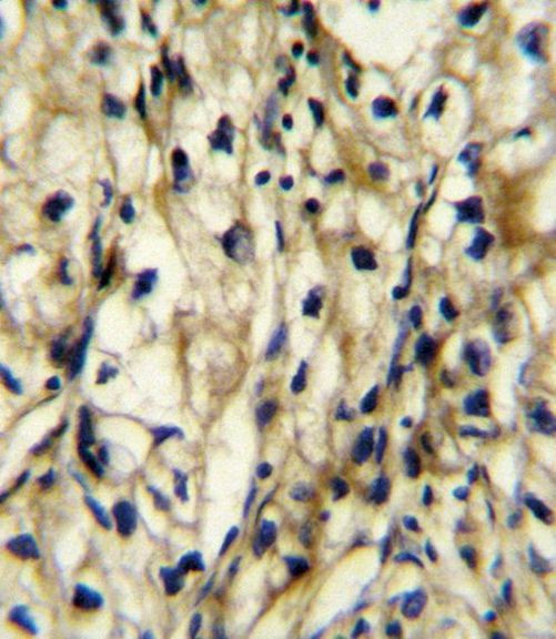 BCAT1 Antibody in Immunohistochemistry (IHC)
