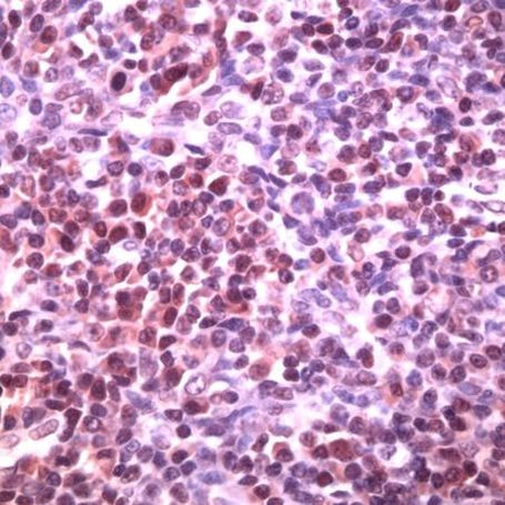 BCL6 Antibody in Immunohistochemistry (IHC)