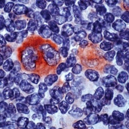 Bcl-X Antibody in Immunohistochemistry (IHC)