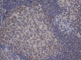 BCL10 Antibody in Immunohistochemistry (Paraffin) (IHC (P))