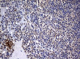 BCL10 Antibody in Immunohistochemistry (Paraffin) (IHC (P))