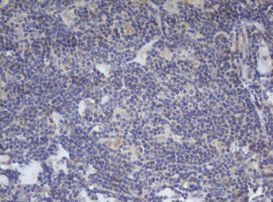 BCL10 Antibody in Immunohistochemistry (Paraffin) (IHC (P))