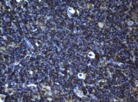BCL10 Antibody in Immunohistochemistry (Paraffin) (IHC (P))