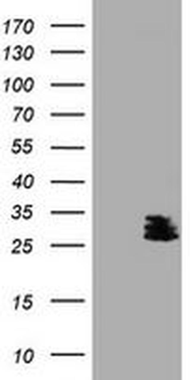 BCL10 Antibody in Western Blot (WB)