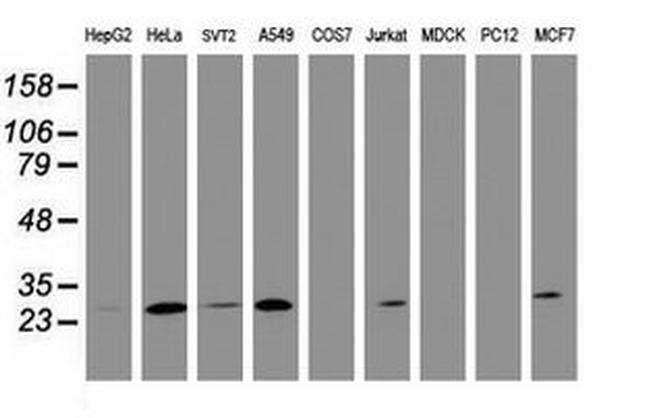 BCL10 Antibody in Western Blot (WB)