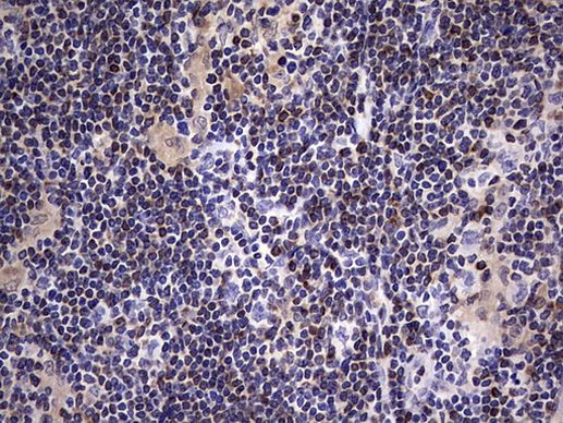 BCL2 Antibody in Immunohistochemistry (Paraffin) (IHC (P))