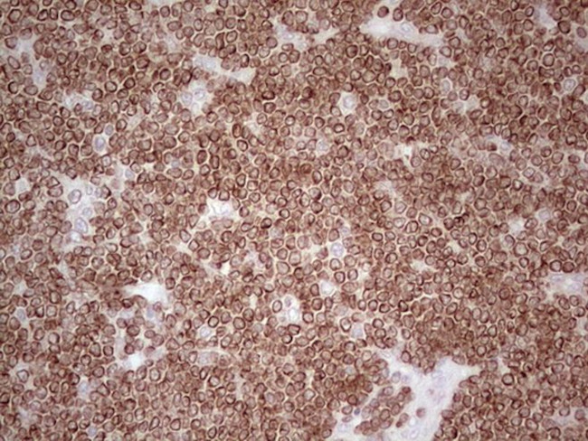 BCL2 Antibody in Immunohistochemistry (Paraffin) (IHC (P))