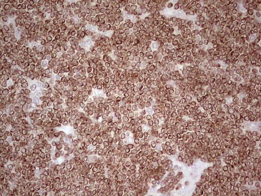 BCL2 Antibody in Immunohistochemistry (Paraffin) (IHC (P))
