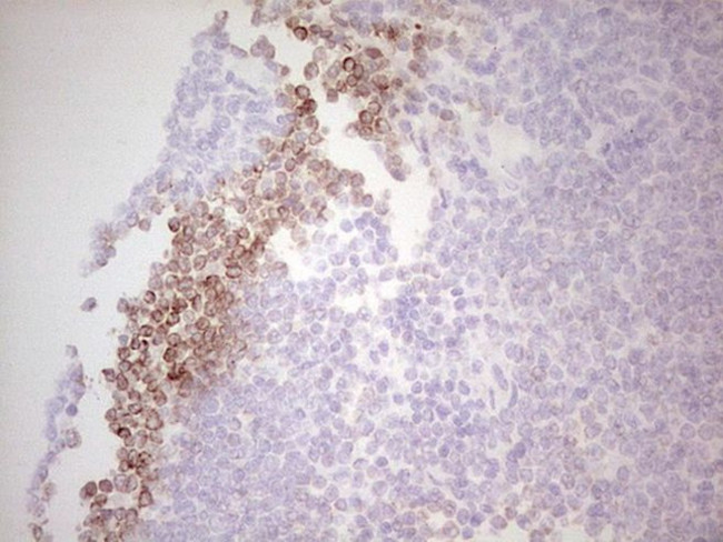 BCL2 Antibody in Immunohistochemistry (Paraffin) (IHC (P))