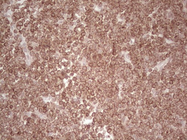 BCL2 Antibody in Immunohistochemistry (Paraffin) (IHC (P))