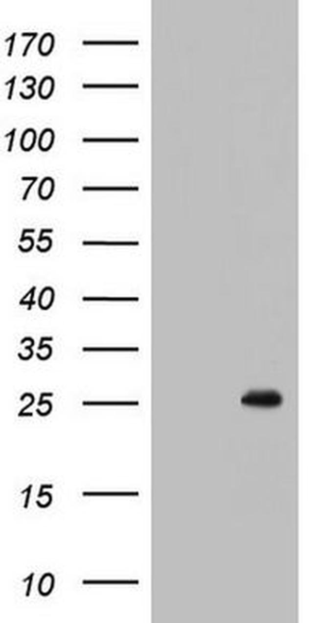 BCL2 Antibody in Western Blot (WB)