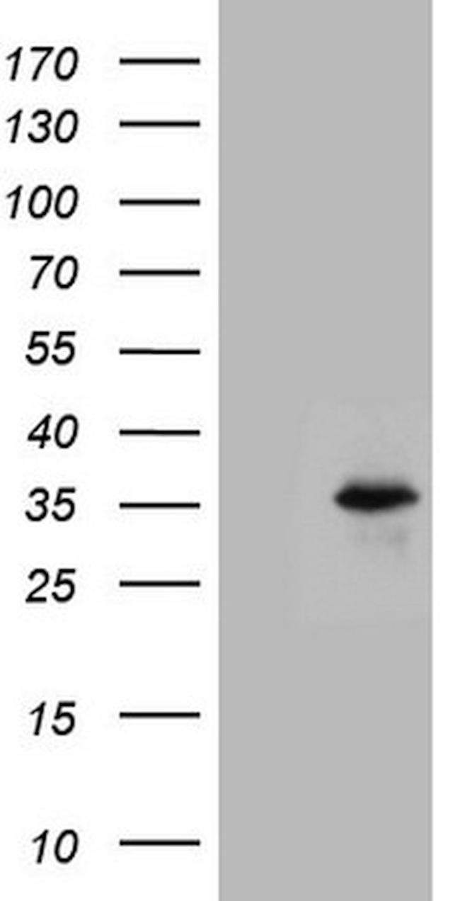 BCL2 Antibody in Western Blot (WB)