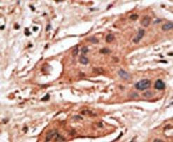 BCL2A1 Antibody in Immunohistochemistry (IHC)